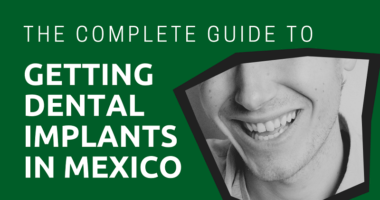 The-Complete-Guide-to-Getting-Dental-Implants-in-Mexico